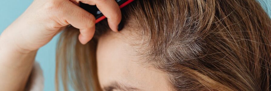 Flake-Free and Fabulous: Products That Transform Your Scalp