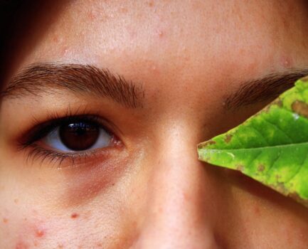 The Ultimate Skincare Pairings for Your Tretinoin Treatment