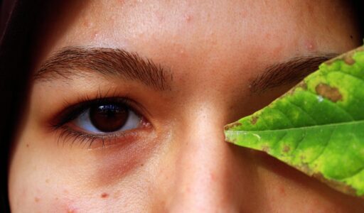 The Ultimate Skincare Pairings for Your Tretinoin Treatment